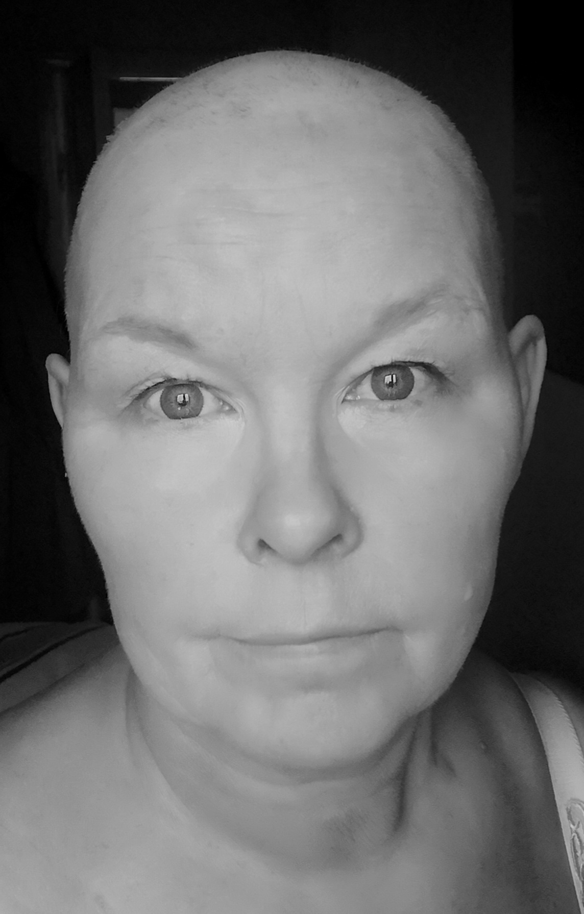 Jag Har Cancer Min Jävla Scrooge